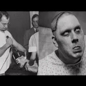 Lobotomy